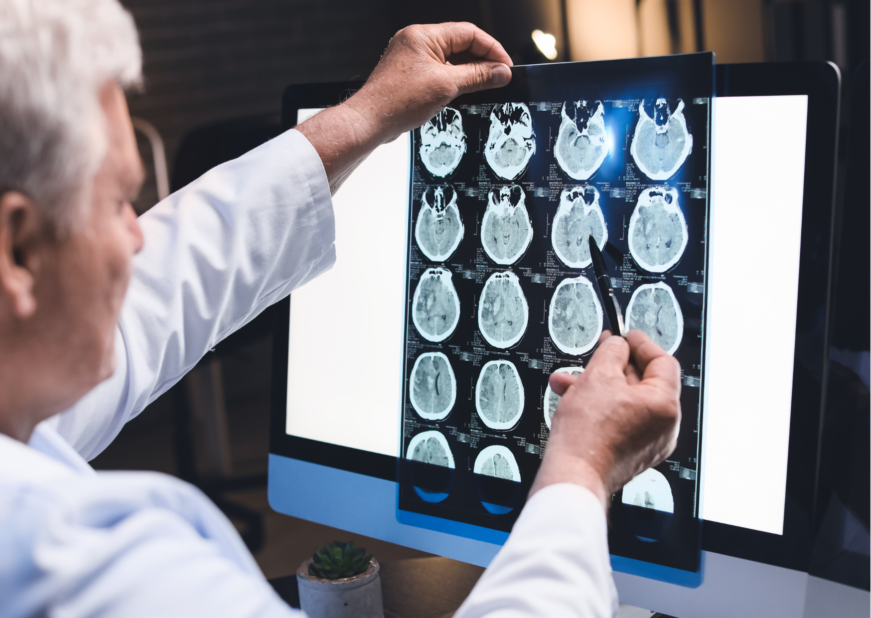 Symptoms After a Concussion: What&rsquo;s Normal and When to Seek Care